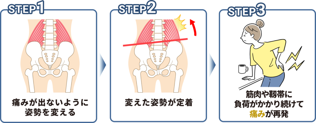 痛みが再発する原因